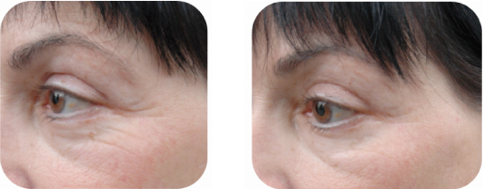 Contour des yeux Contour des yeux