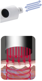 microdermabrasion percussive : détail de la pièce et schéma d'action microdermabrasion percussive : détail de la pièce et schéma d'action
