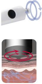 microdermabrasion orbitale : détail de la pièce et schéma d'action microdermabrasion orbitale : détail de la pièce et schéma d'action