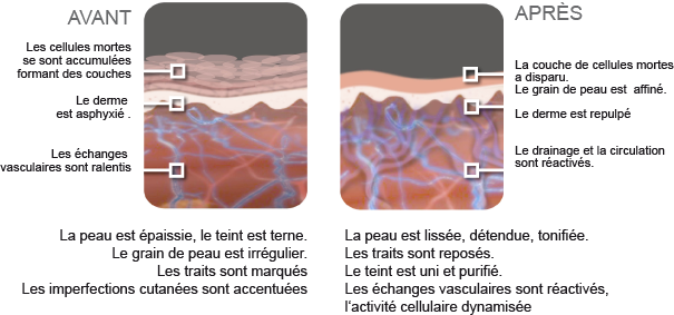 avant-après : élimination des cellules mortes sur le derme avant-après : élimination des cellules mortes sur le derme