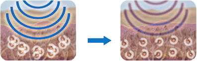 Fonctionnement des ultrasons Fonctionnement des ultrasons